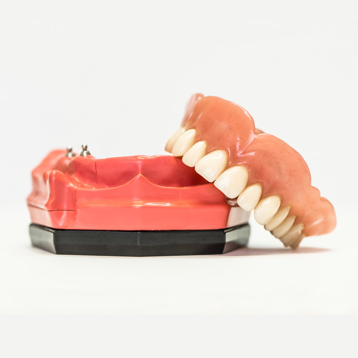 dentures