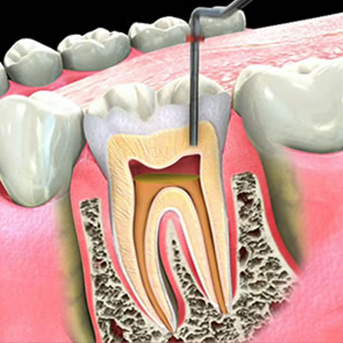 endo mouth work